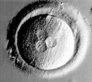 IVF embryo development - abnormal fertilization