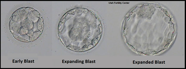 IVF embryo development - blastocyst stage - day 5