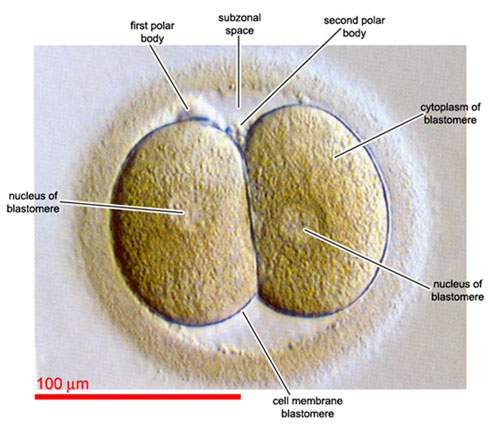 IVF embryo development - embryo symmetry