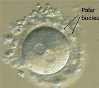 IVF embryo development polar bodies