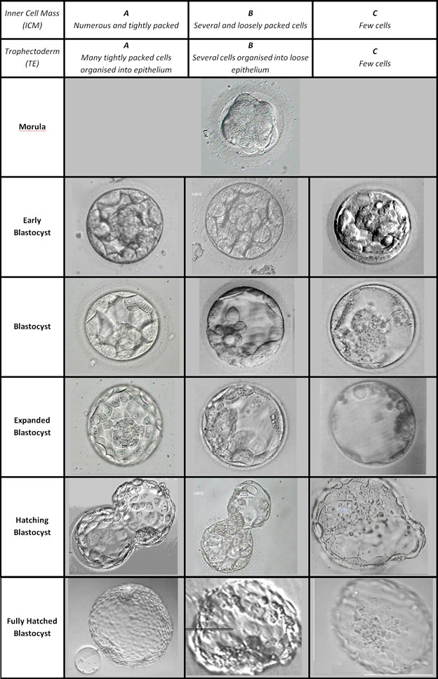 IVF embryo development - quality - grading