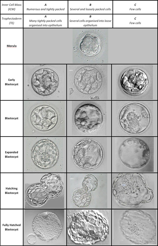 Embryoudvikling - indsigt i IVF Lab EggDonationFriends.com